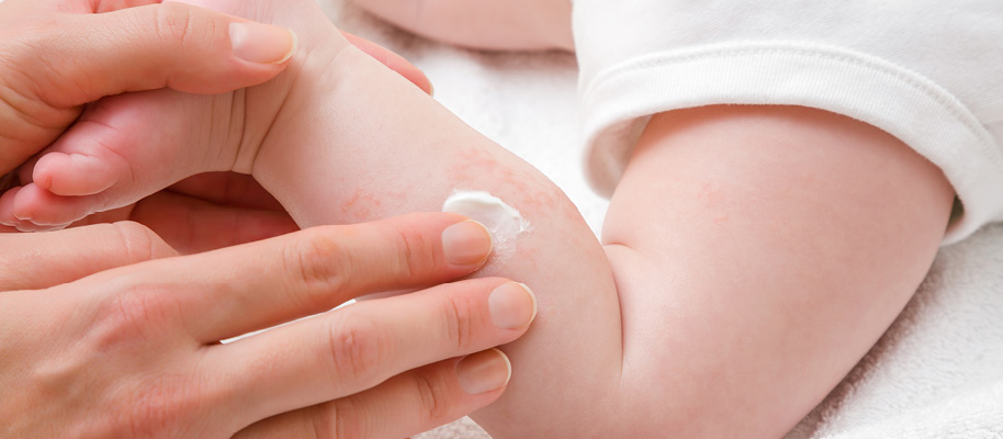 Ratgeber Baby Hautpflege - IBIOTICS 2